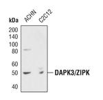 ZIPK Antibody in Western Blot (WB)