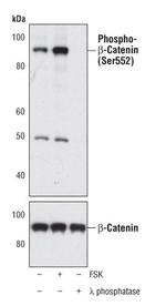 Phospho-beta Catenin (Ser552) Antibody