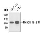 HK2 Antibody in Western Blot (WB)