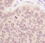 SUMO1 Antibody in Immunohistochemistry (Paraffin) (IHC (P))