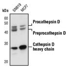 Cathepsin D Antibody in Western Blot (WB)