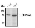 TBK1 Antibody in Western Blot (WB)