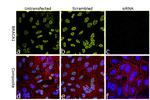 BRCA1 Antibody