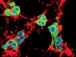 Lamin A (Cleaved Asp230) Antibody in Immunocytochemistry (ICC/IF)