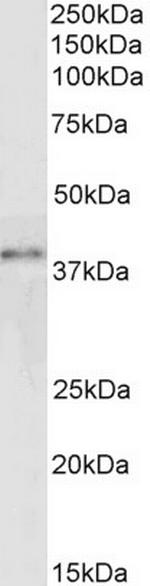 GRAP2 Antibody in Western Blot (WB)