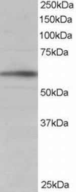 BAIAP2 Antibody in Western Blot (WB)