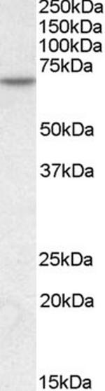 MTM1 Antibody in Western Blot (WB)