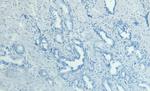 MKP-1 Antibody in Immunohistochemistry (Paraffin) (IHC (P))