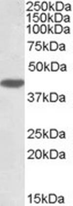 MKP-1 Antibody in Western Blot (WB)