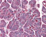 LIS1 Antibody in Immunohistochemistry (Paraffin) (IHC (P))