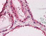 LIS1 Antibody in Immunohistochemistry (Paraffin) (IHC (P))