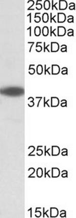 LIS1 Antibody in Western Blot (WB)