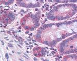 ACSL4 Antibody in Immunohistochemistry (Paraffin) (IHC (P))