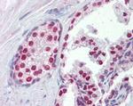 FOXA1 Antibody in Immunohistochemistry (Paraffin) (IHC (P))