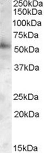 PIST Antibody in Western Blot (WB)