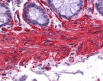 Alpha-Smooth Muscle Actin Antibody in Immunohistochemistry (Paraffin) (IHC (P))