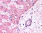 LRP6 Antibody in Immunohistochemistry (Paraffin) (IHC (P))