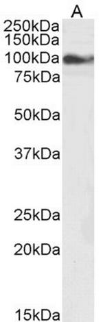 TRPC6 Antibody in Western Blot (WB)