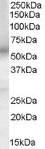 PTGER4 Antibody in Western Blot (WB)