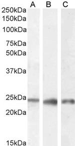 PGRMC1 Antibody in Western Blot (WB)