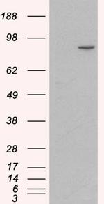 Catenin alpha-1 Antibody in Western Blot (WB)