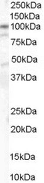 Catenin alpha-1 Antibody in Western Blot (WB)