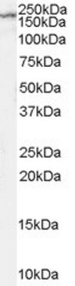 NMDAR2B Antibody in Western Blot (WB)