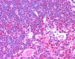 Munc13-4 Antibody in Immunohistochemistry (Paraffin) (IHC (P))