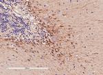 COMT Antibody in Immunohistochemistry (Paraffin) (IHC (P))