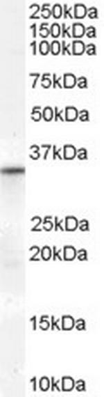 VDAC2 Antibody in Western Blot (WB)