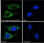 Biglycan Antibody in Immunocytochemistry (ICC/IF)