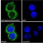 Biglycan Antibody in Immunocytochemistry (ICC/IF)