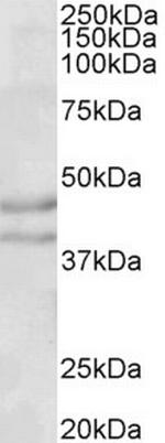 NPY2R Antibody in Western Blot (WB)
