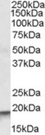 ARPC4 Antibody in Western Blot (WB)