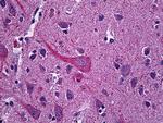 Synaptotagmin 1 Antibody in Immunohistochemistry (Paraffin) (IHC (P))