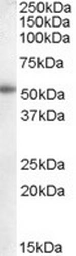 Aromatase Antibody in Western Blot (WB)