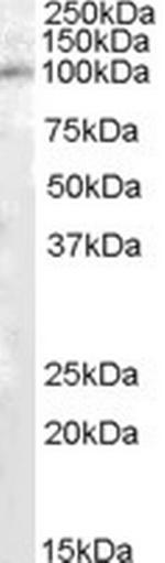 PAM Antibody in Western Blot (WB)