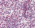 PU.1 Antibody in Immunohistochemistry (Paraffin) (IHC (P))