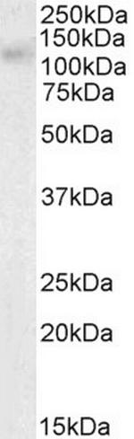 ABCC11 Antibody in Western Blot (WB)