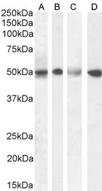 SEPT6 Antibody in Western Blot (WB)