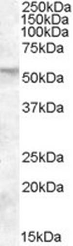 FKBP4 Antibody in Western Blot (WB)