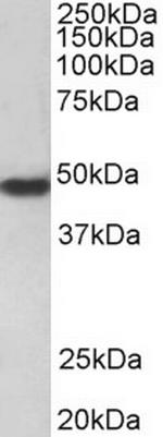 PAR1 Antibody in Western Blot (WB)