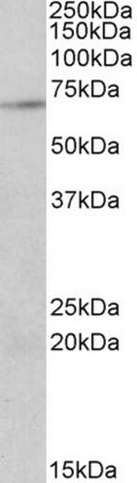 PRMT5 Antibody in Western Blot (WB)