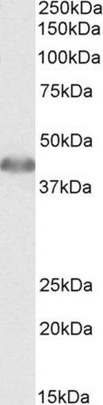 ACAT1 Antibody in Western Blot (WB)