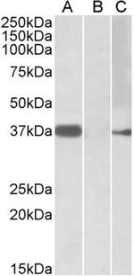 MYF6 Antibody in Western Blot (WB)