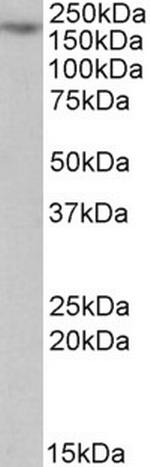 MYO5A Antibody in Western Blot (WB)