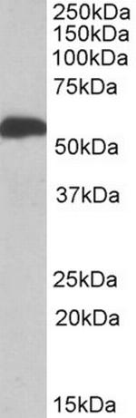 ALDH5A1 Antibody in Western Blot (WB)