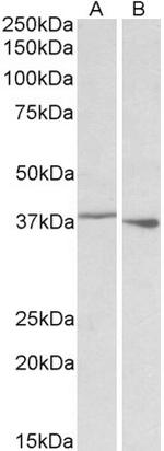 PCBP1 Antibody in Western Blot (WB)