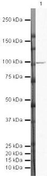 DAB2 Antibody in Western Blot (WB)