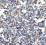 CCR5 Antibody in Immunohistochemistry (IHC)